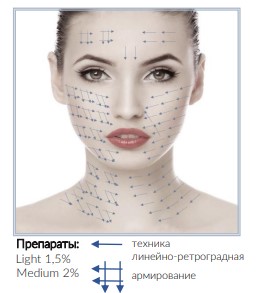 линейно ретрог.jpg