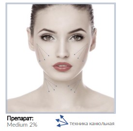 канюльн тех.jpg