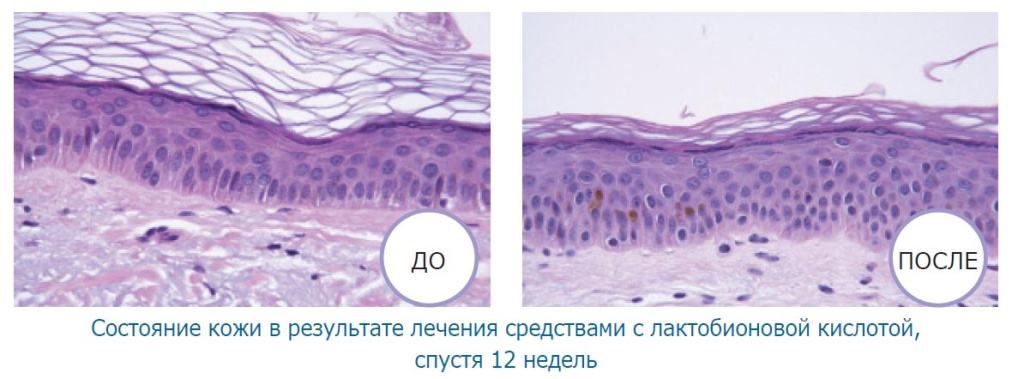 lactobionovaya-kislota-neostrata2.jpg