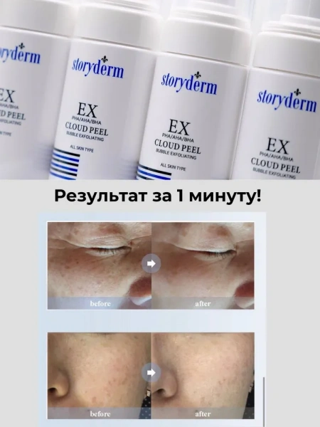 Пилинг для домашнего использования от пигментации Storyderm  EX cloud peel, 80 мл