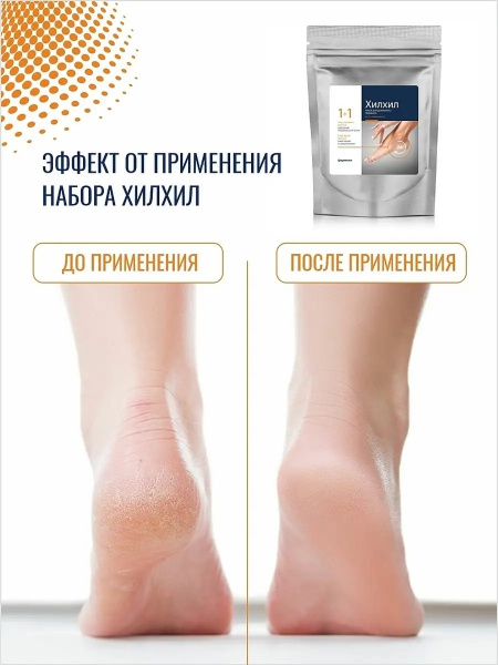 Набор для домашнего педикюра Хилхил Фармхил, 100 гр, Набор для домашнего педикюра Хилхил Фармхил, 100 гр,