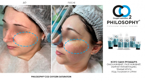 Набор карбокситерапии CO2 Philosophy CO2 Kit CO2 Oxygen Saturation Home