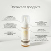 Пенка-мусс для умывания для проблемной кожи лица Anti-acne Dr.Kozhevatkin, 150 мл.